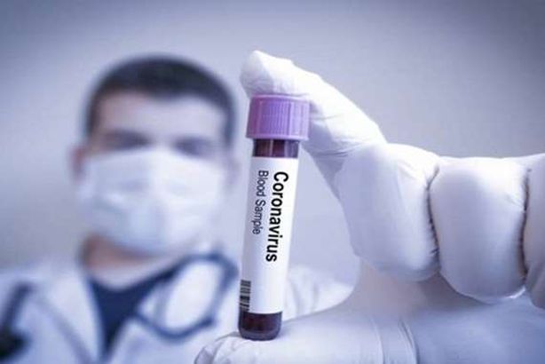 علاج كورونا