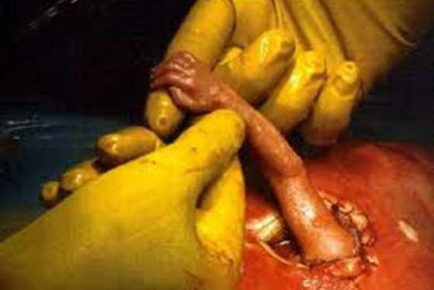 حادث يفوق الخيال.. جنين يقفز من بطن أمه