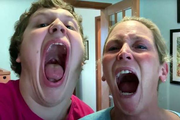 أكبر فم في العالم