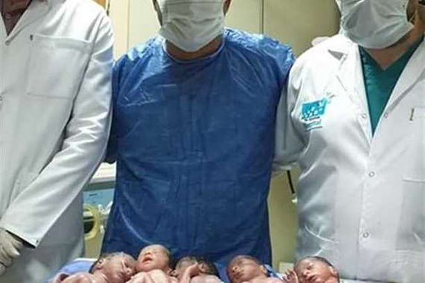 التوائم والاطباء