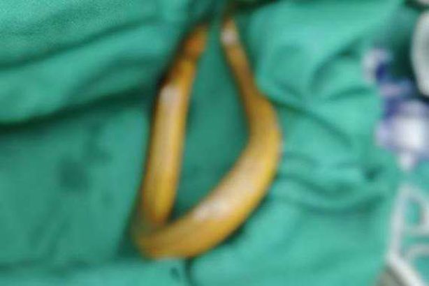 ليست نكتة.. يبتلع ثعبانا لعلاج الإمساك