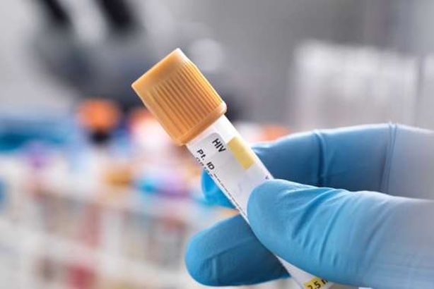 تحاليل كورونا