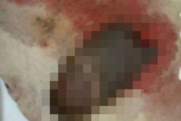 تقطع قضيب زوجها بعد زواجه من أخرى