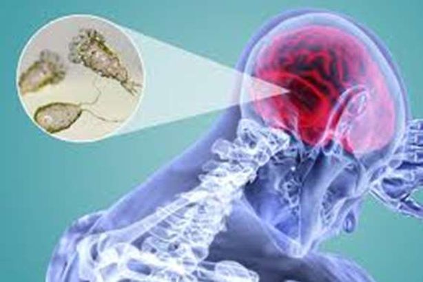 الأميبا آكلة الدماغ