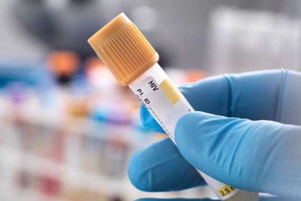 شفاء أول مصاب بالإيدز بعد خضوعه لعلاج فريد من نوعه 
