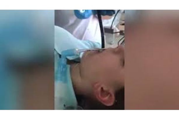 أطباء يستخرجون ثعبانا من فم سيدة يتجاوز المتر
