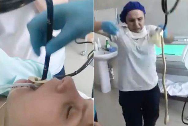 لحظة استخراج ثعبان من فم امرأة