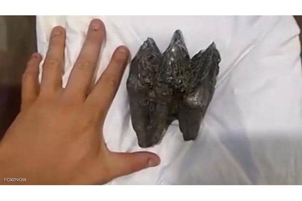 السن العملاق