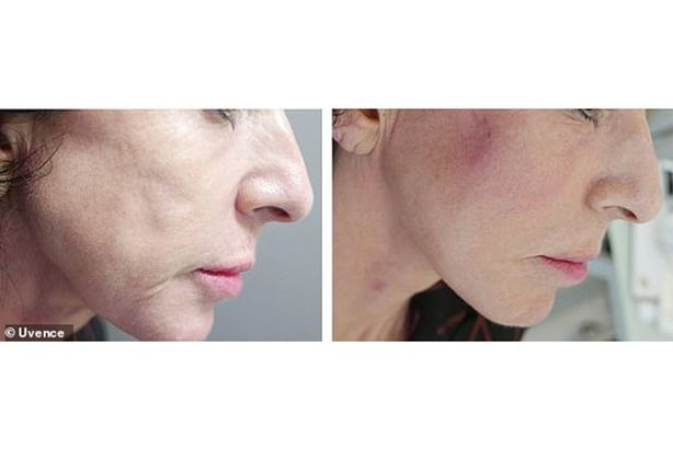 علاج طبيعي لعلاج التجاعيد وإخفاء الشيخوخة