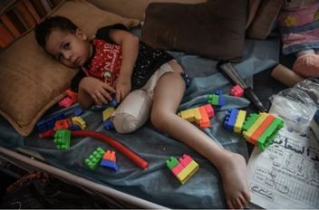طفل بترت ساقه في قطاع غزة