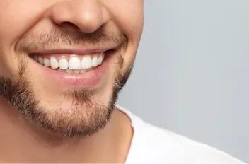 عروض الأسنان .. اجلب كفيلين واحصل على ابتسامة مقسطة على سنتين