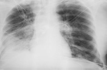 ما مدى خطورة الأشعة السينية على الصحة ؟
