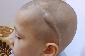 الطفل يوسف المومني