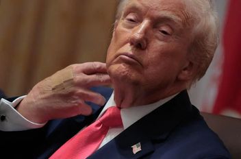 ترامب يظهر مرة أخرى بضمادة على معصمه