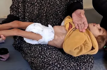 أطفال غزة يموتون جوعاً