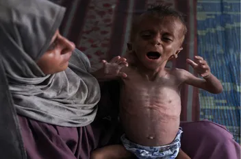 أطباء بلا حدود: ربع أطفال غزة يعانون سوء التغذية

