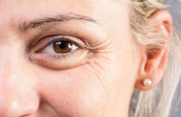كيف تكشف تجاعيد العينين أسرار صحة الدماغ - الوكيل الإخباري