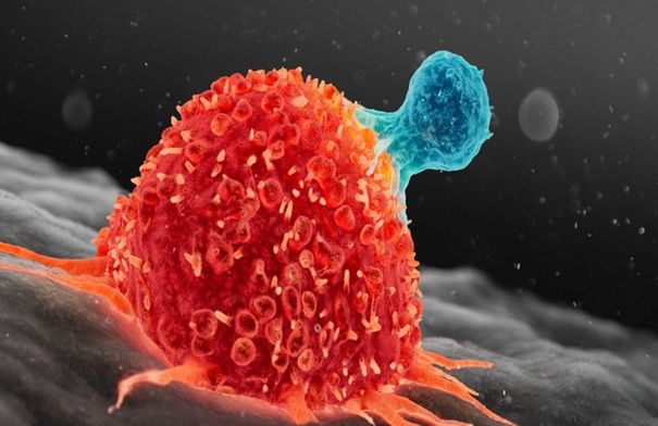 هدف علاجي جديد ضد السرطان يظهر على خلايا الأورام 