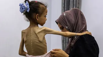 Death Toll from Famine in Gaza Rises to 332