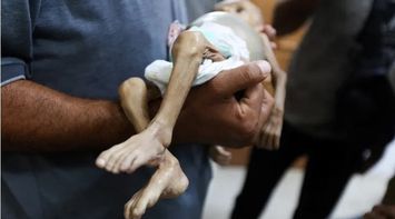 Gaza Health: 6 New Deaths Due to Famine and Malnutrition