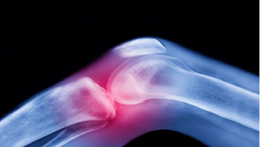 The Most Effective Treatment for Joint Pain Before Medications and Surgery