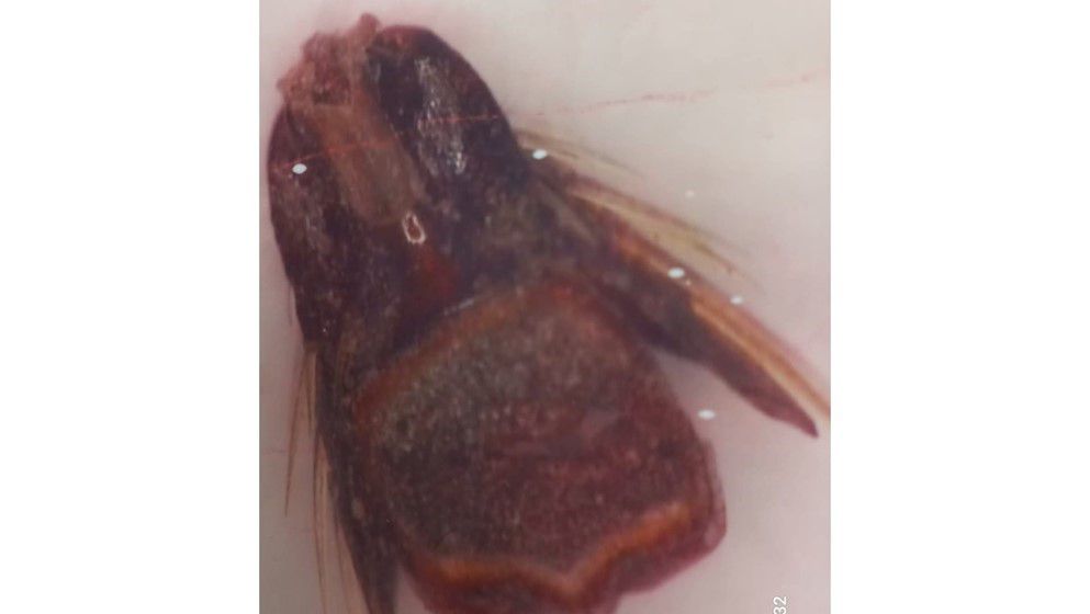 Discovery of Pads in the Legs of a Stick Insect 140 million years old in Jordanian amber