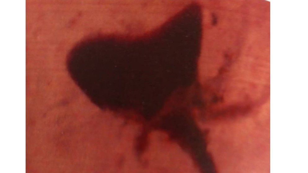 Dr. Abbas Haddadin Discovers a 140-Million-Year-Old Flower in Jordanian Amber Resembling an Anemone