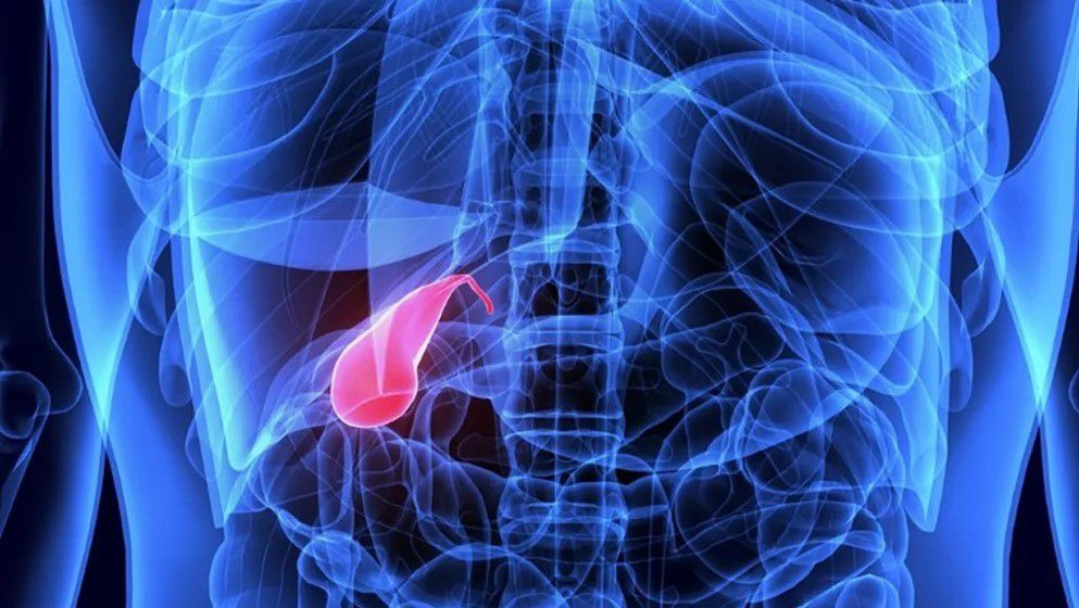 The Skin as a Diagnostic Indicator for Gallbladder Disorders