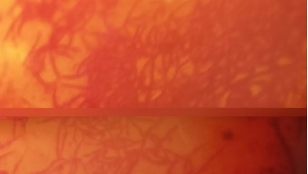 Lichens Preserved in Jordanian Amber