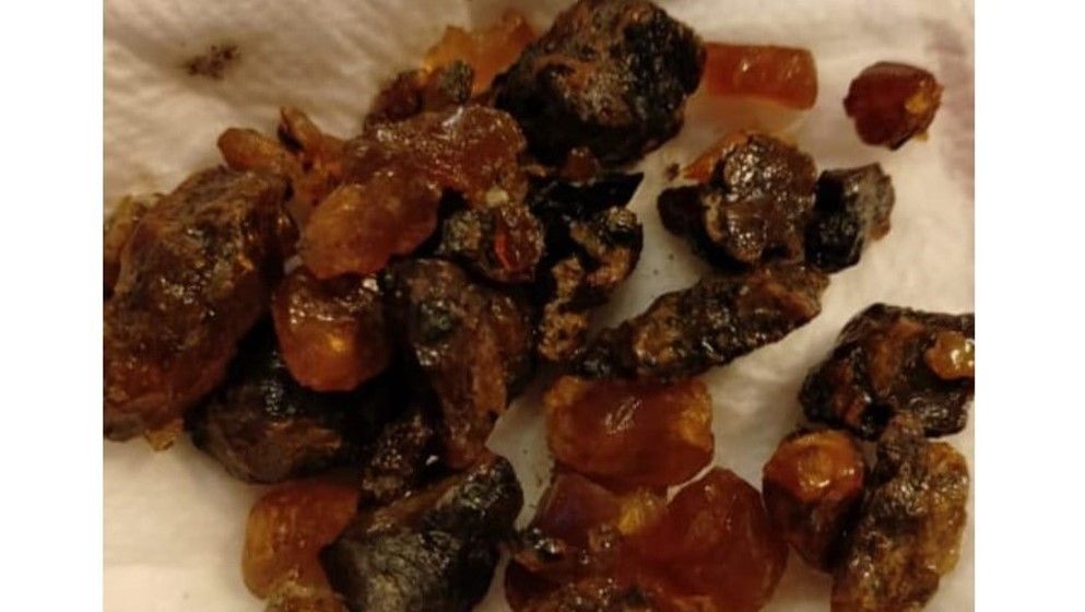 Jordanian Amber and the Use of Resin Incense in Ancient Temples
