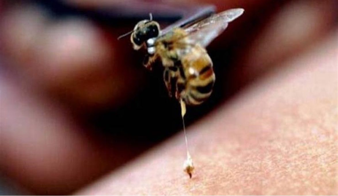 لسعة نحلة تدفع رجلاً إلى حافة الموت